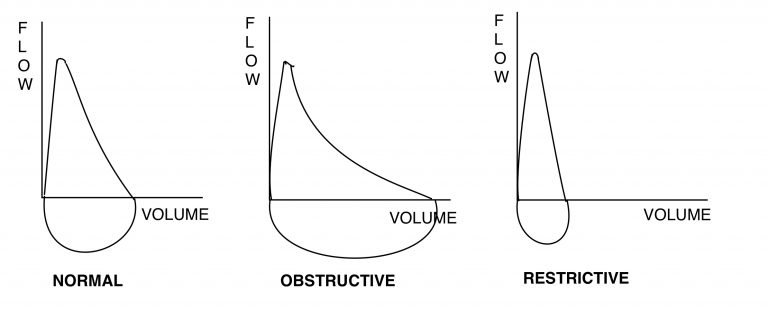 Flow volume loops - Respiratory Cram Blog